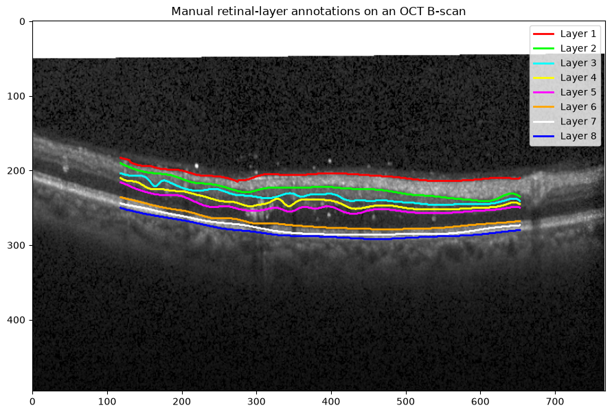 Manual retinal-layer annotations on an OCT B-scan, showing eight labeled boundary layers